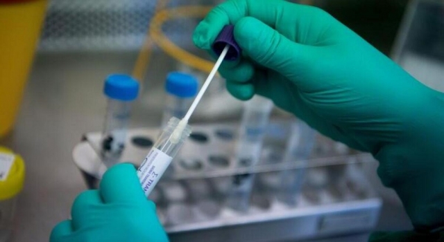 Covid-19 PCR testleri Gümüşhane’de yapılıyor..